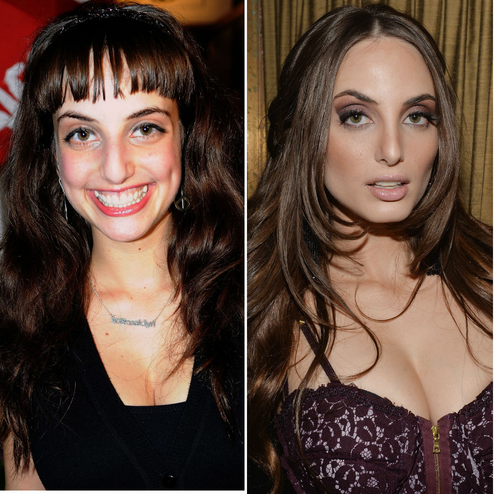 Billy Joel S Daughter Alexa Ray Is Unrecognizable More Plastic Surgery Or A Case Of Growing Up Life Style