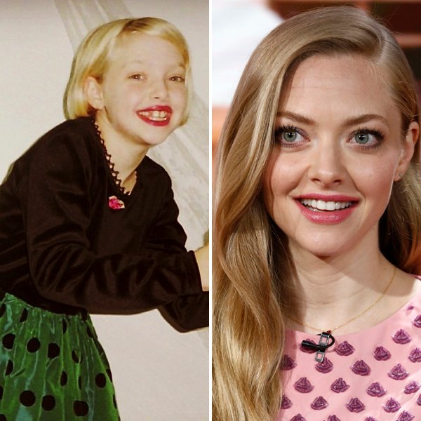 Amanda seyfried teeth
