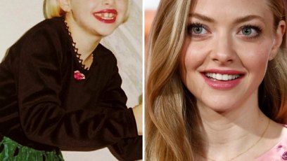 Amanda seyfried teeth