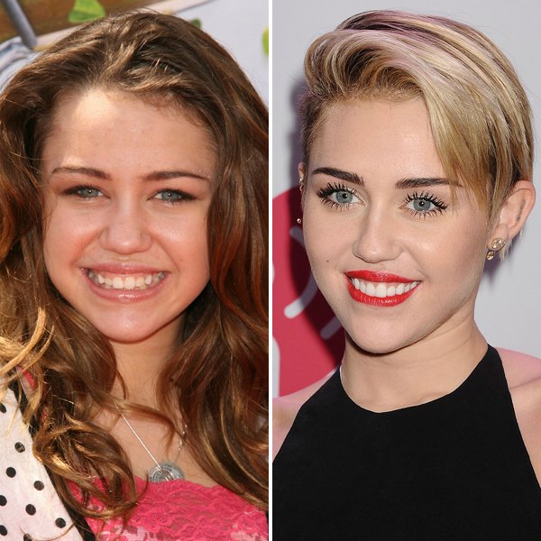 Miley cyrus teeth