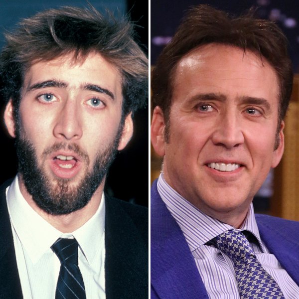 Nicolas cage teeth