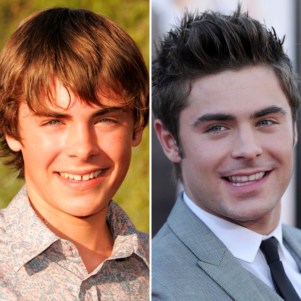 Zac efron teeth