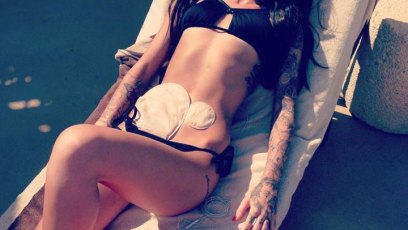 Model poses colostomy bag bikini
