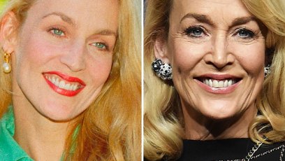 Botox free celebrities plastic surgery 1