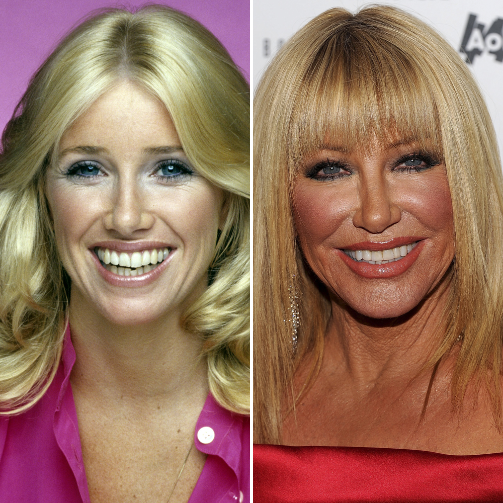 Suzanne somers