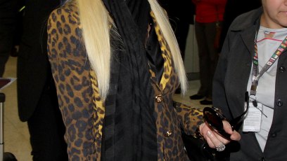 Donatella versace plastic surgery face 1