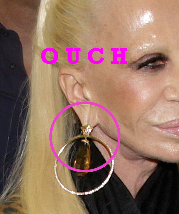 donatella plastic surgery face