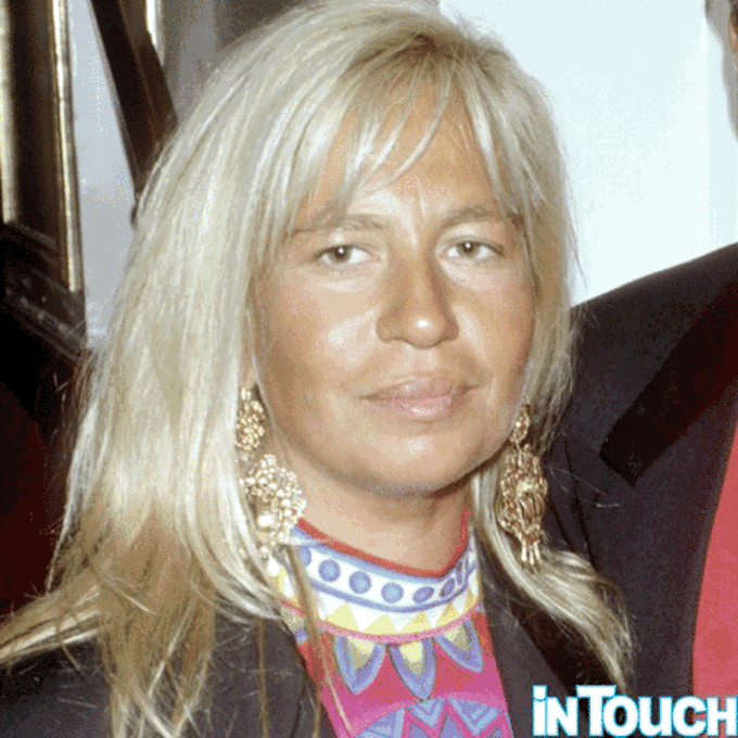 donatella versace plastic surgery face