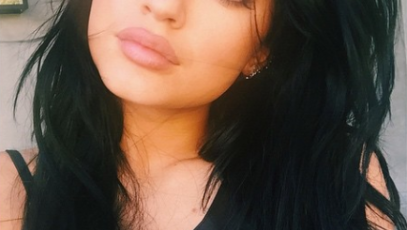 Plastic surgeon gives his opinion on kylie jenner