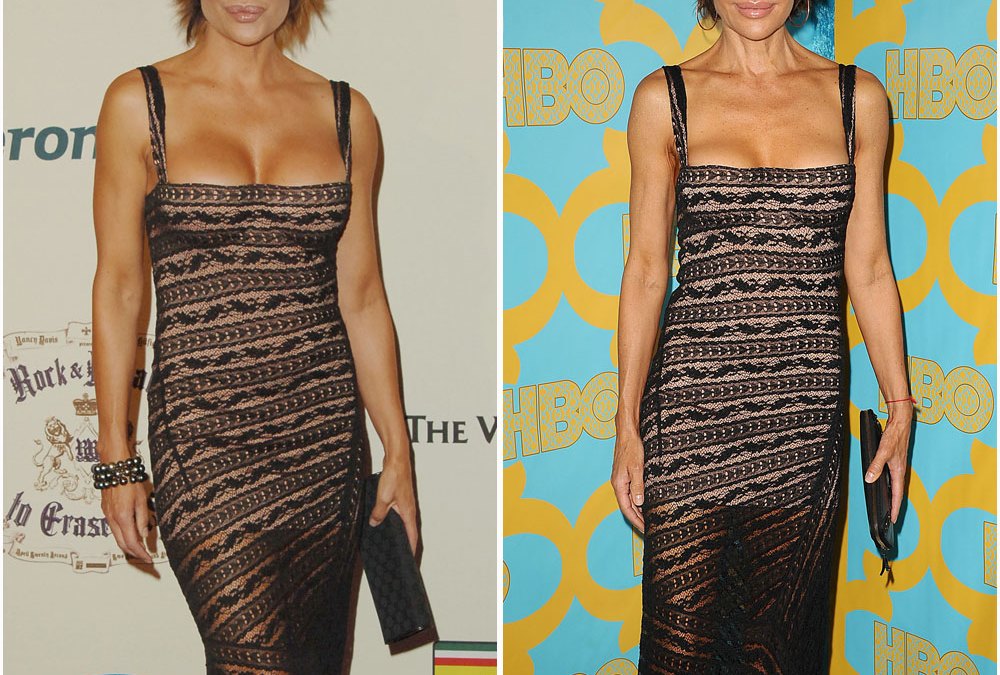 Lisa rinna same dress face boobs