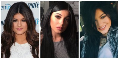 kylie jenner plastic surgery 2 kylie jenner plastic surgery 2