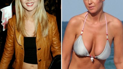 Tara reid plastic surgery