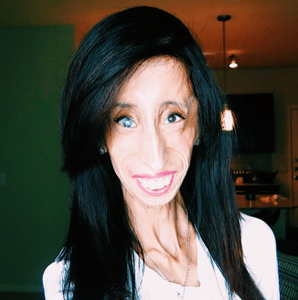 Lizzie velasquez