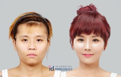 south korea plastic surgery show south korea plastic surgery show
