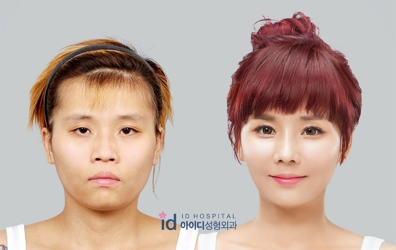 south korea plastic surgery show