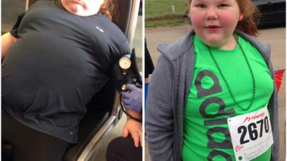 Weight loss surgery pre teen