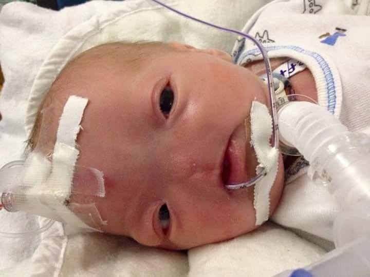 Baby pics