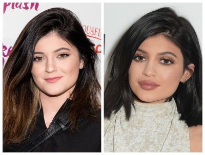 kylie jenner lip fillers kylie jenner lip fillers