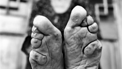 Bound feet 7