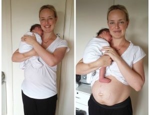 Postpartum body 2