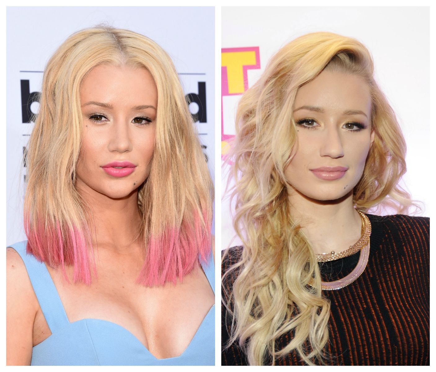 iggy azalea plastic surgery