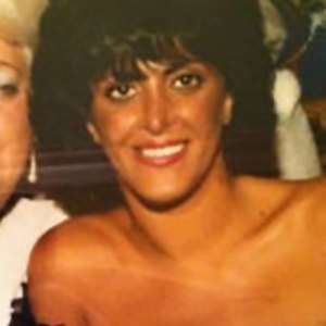 Big ang before surgery