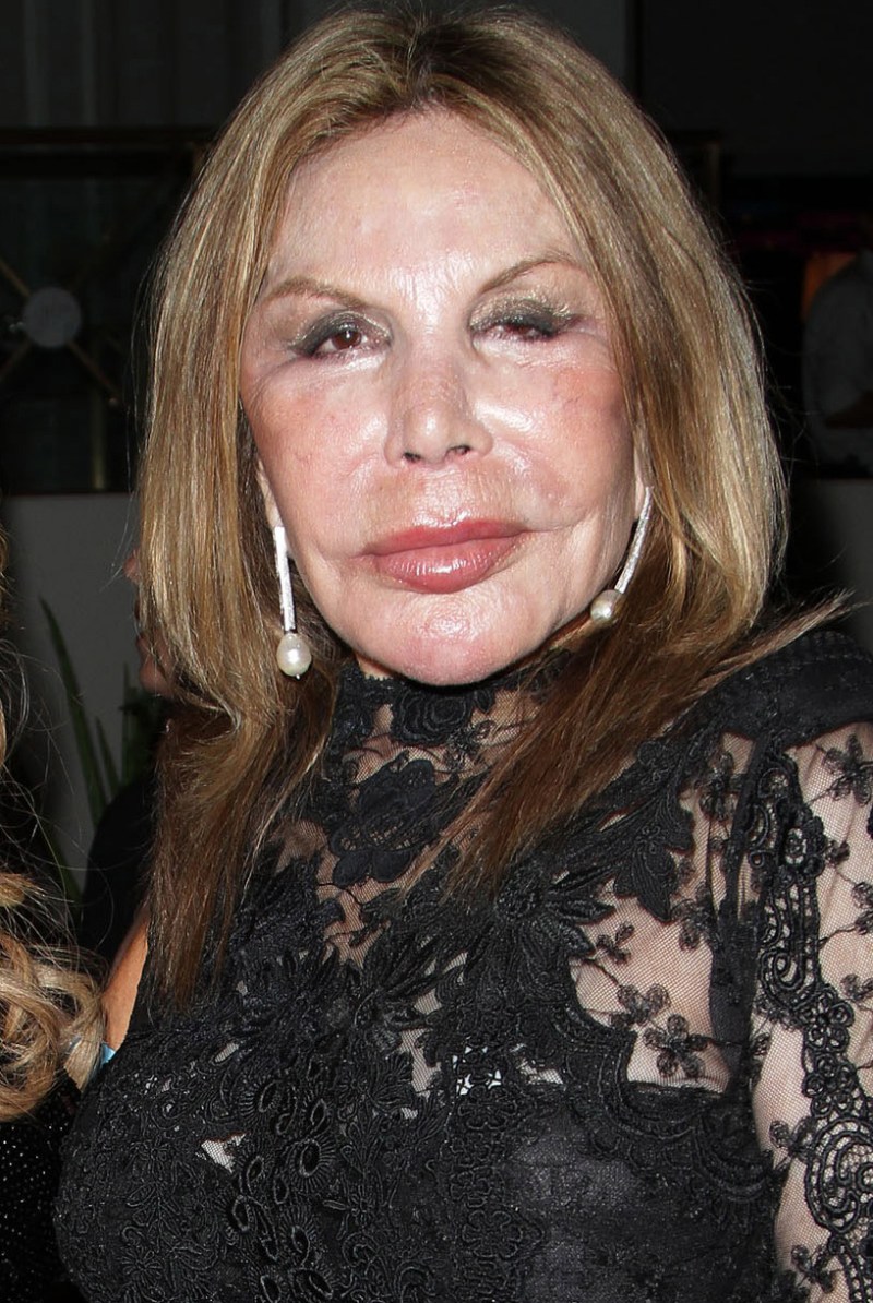 Elsa Patterson See Mama Elsa Patton's Shocking Plastic Surgery Transformation Right ...