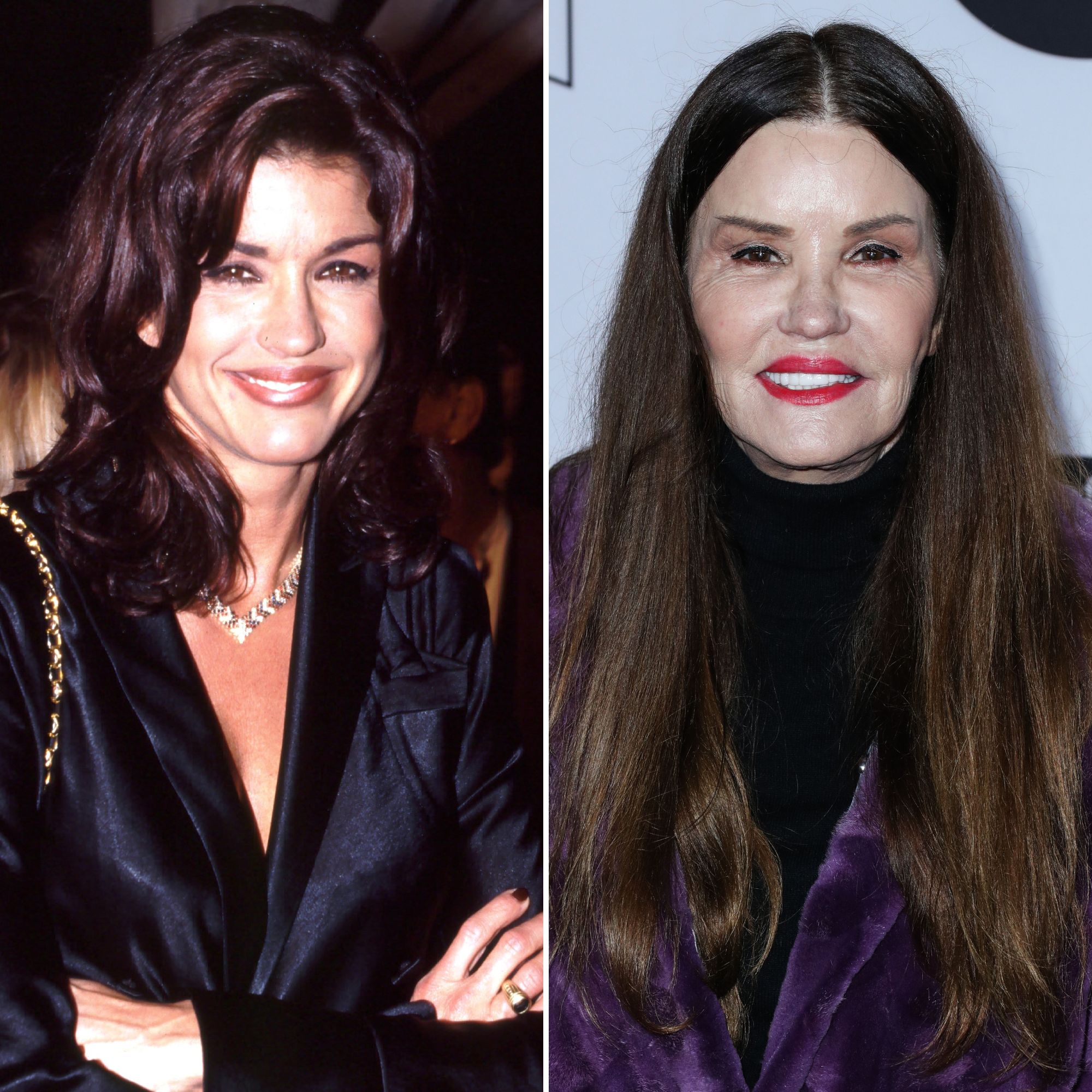 Janice Dickinson Plastic Surgery: Before, After Photos