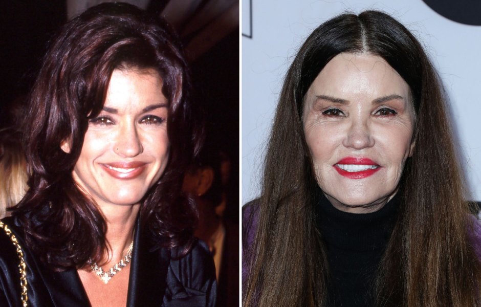 Janice Dickinson Plastic Surgery: Before, After Photos