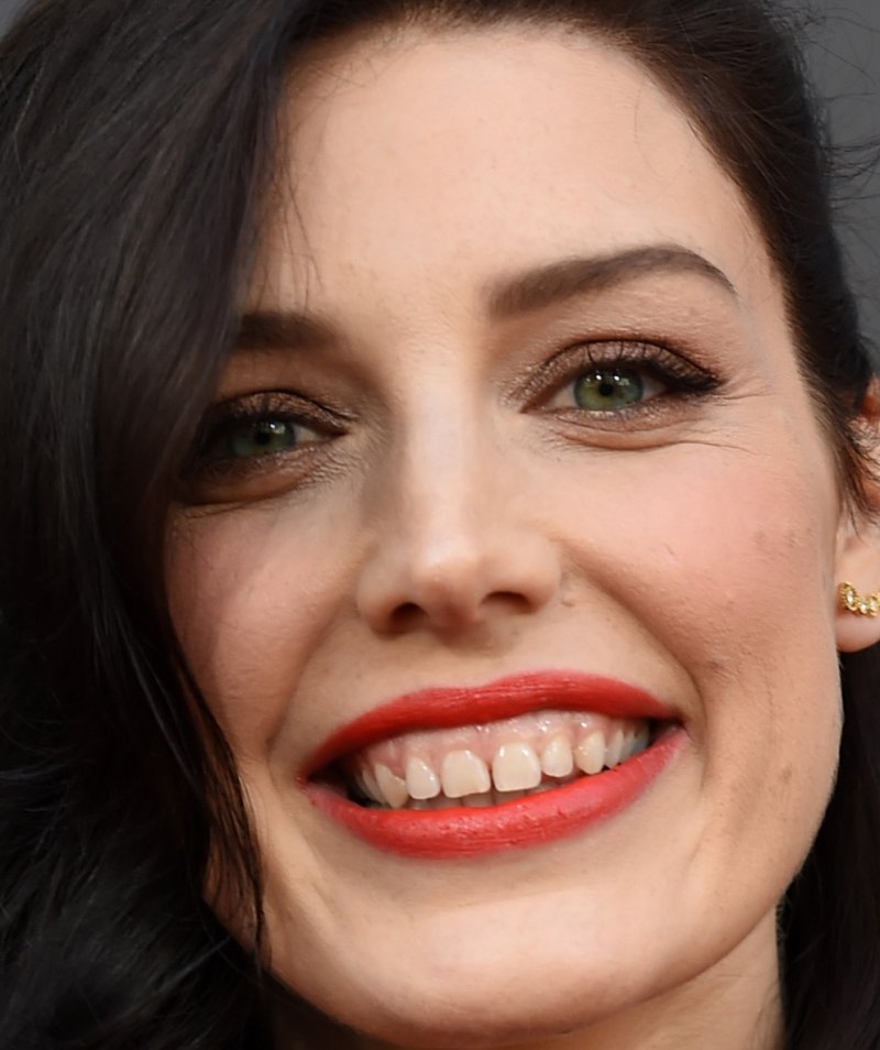 Jessica pare teeth