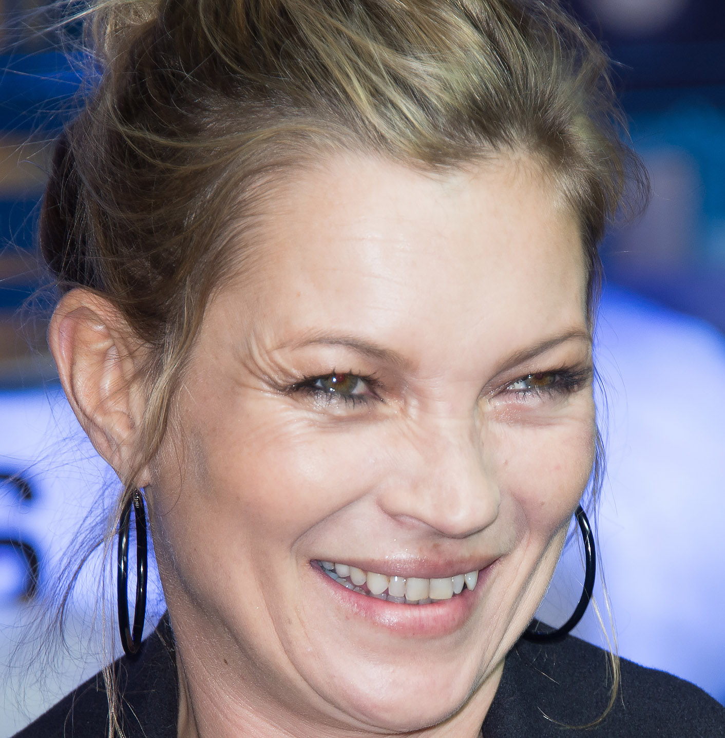 Kate moss teeth