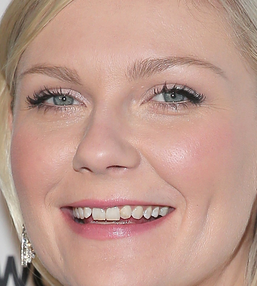 Kristen dunst teeth