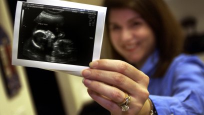 Ultrasound photo facebook