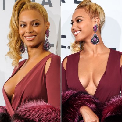 Did Beyoncé Have Plastic Surgery After Giving Birth to Blue Ivy? - Life & Style