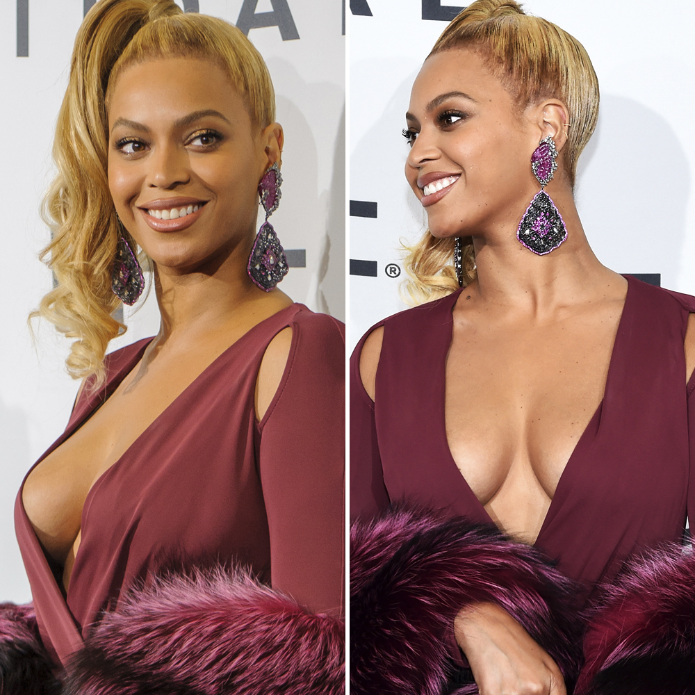 beyonce boob lift