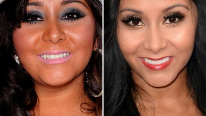 Snooki veneers