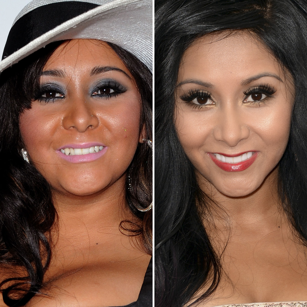 Snooki, Cheryl Crow, and More Stars Rumored to Have Fake Teeth - Life & Style