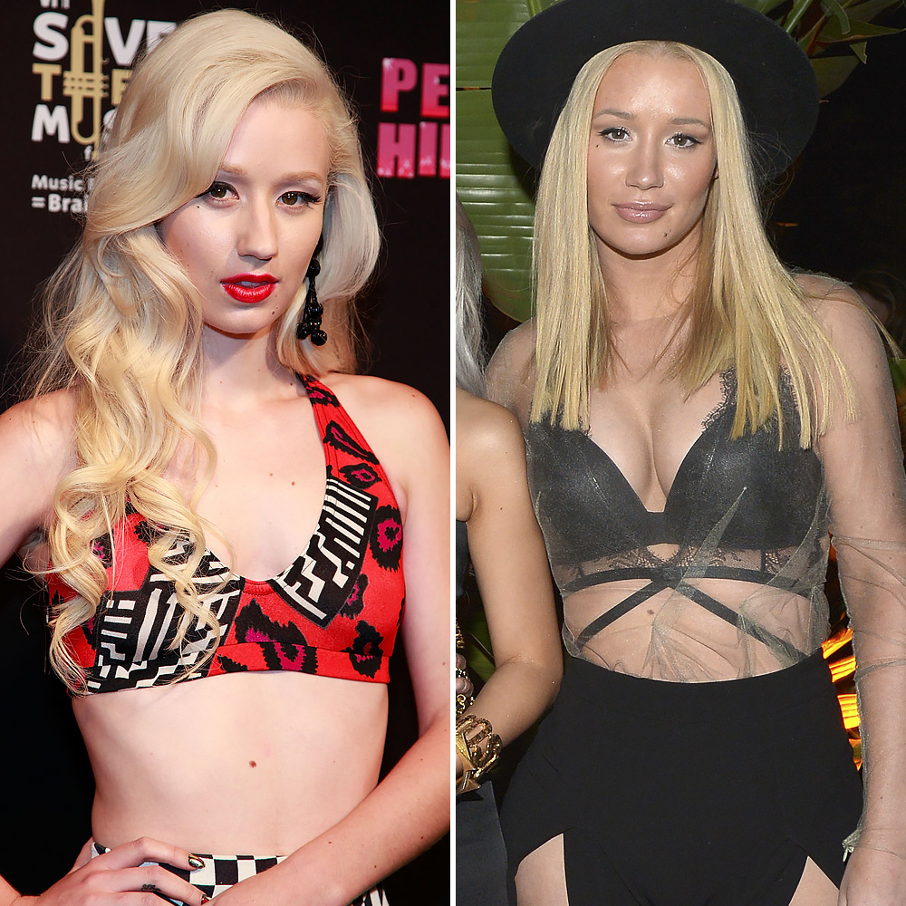 Iggy Azalea, Kaley Cuoco, and More Stars Who Have Admitted to Getting a  Boob Job – See Their Before-and-After Pics - Life & Style
