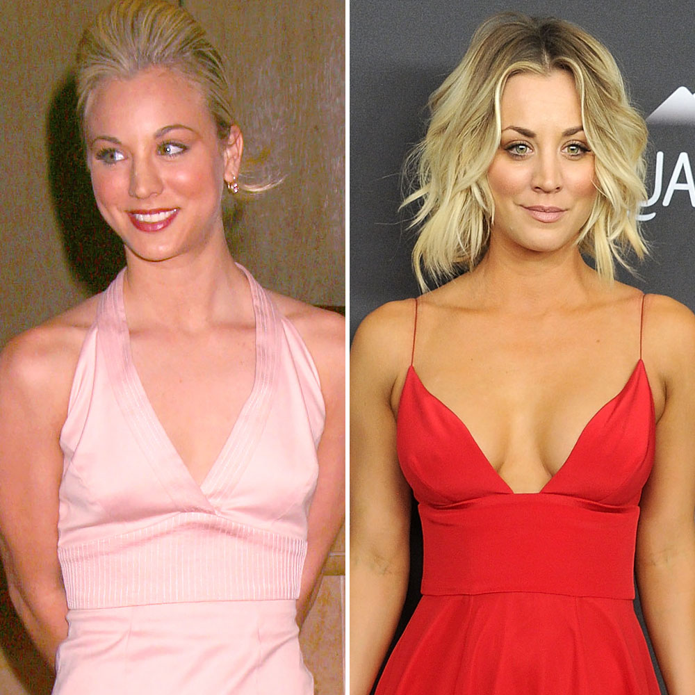 Iggy Azalea, Kaley Cuoco, and More Stars Who Have Admitted to Getting a Boob  Job â€“ See Their Before-and-After Pics - Life & Style