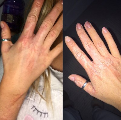 perrie edwards burn perrie edwards burn