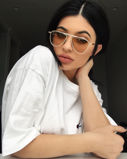 Kylie jenner lip injections
