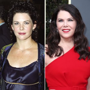 Lauren Graham Transformation Plastic Surgery