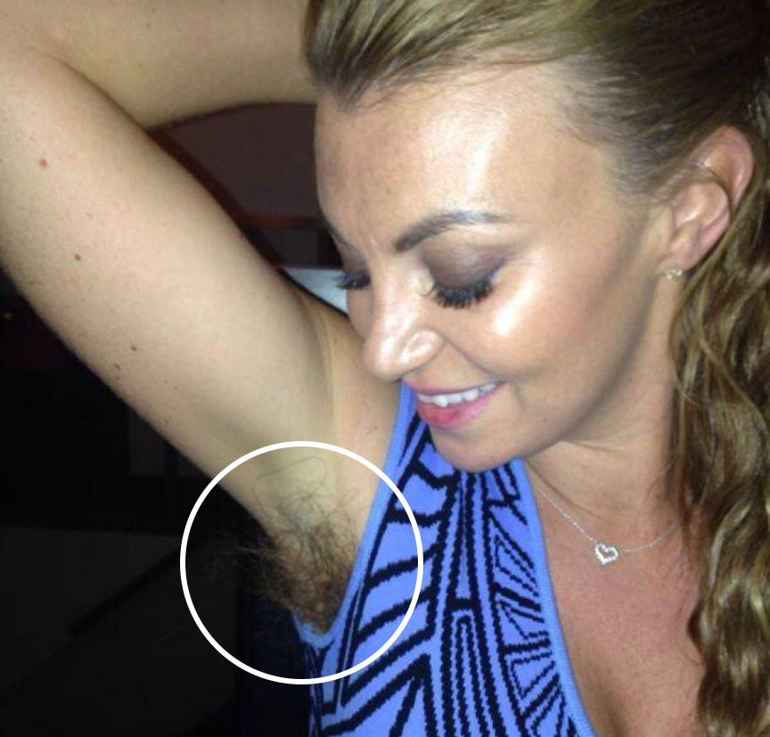 Billi mucklow hairy