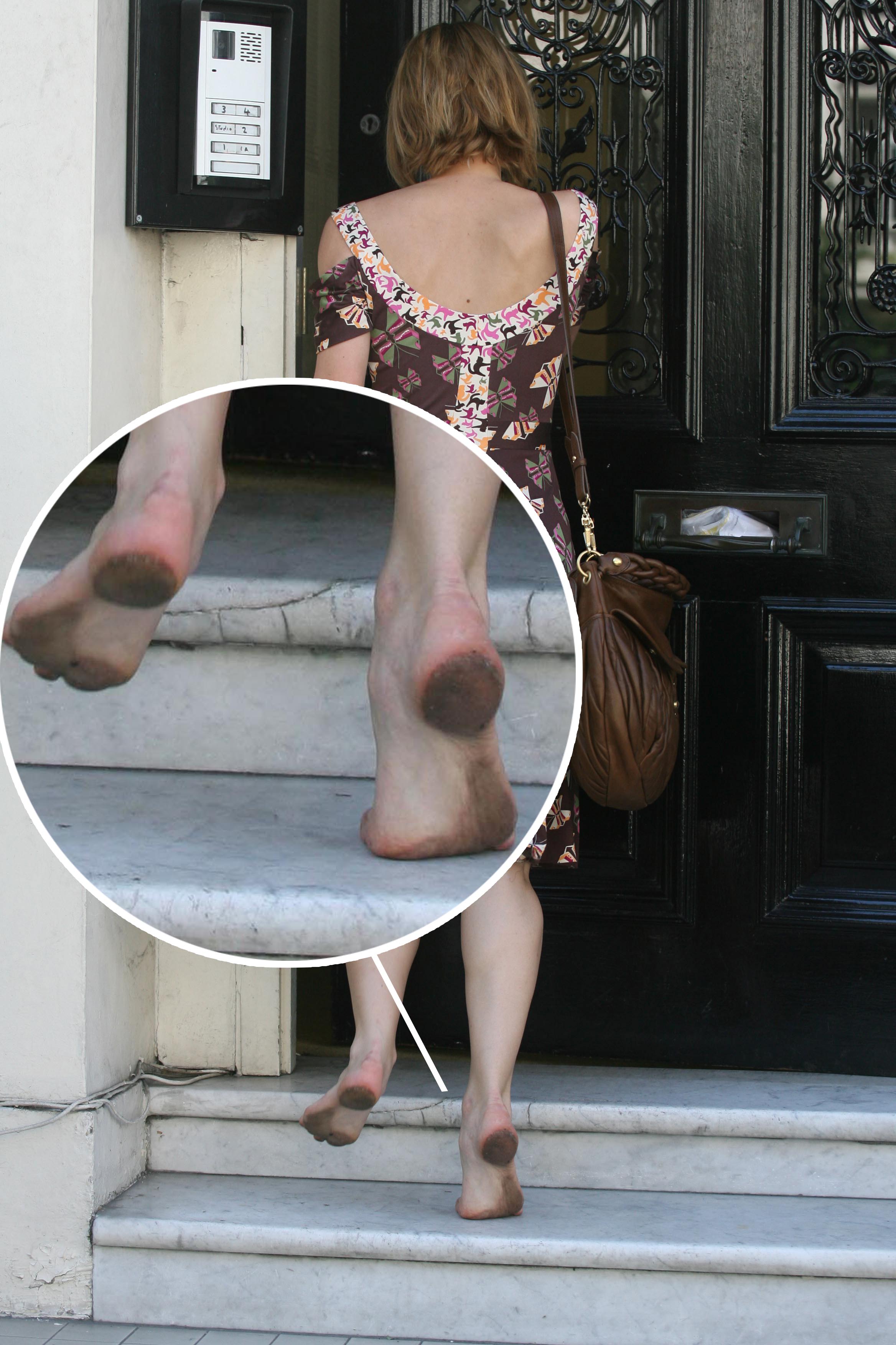 Keira knightley feet