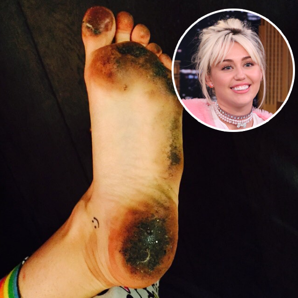 Miley Cyrus Foot Fetish - Stars Who Regretted Going Barefoot in Public