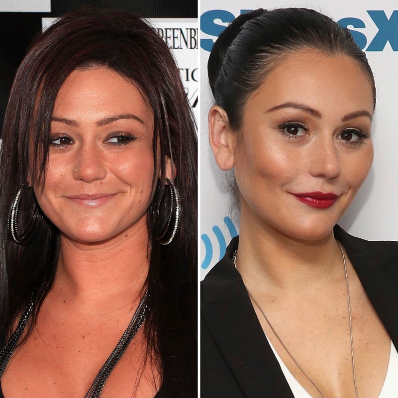 Plastic surgery jwoww