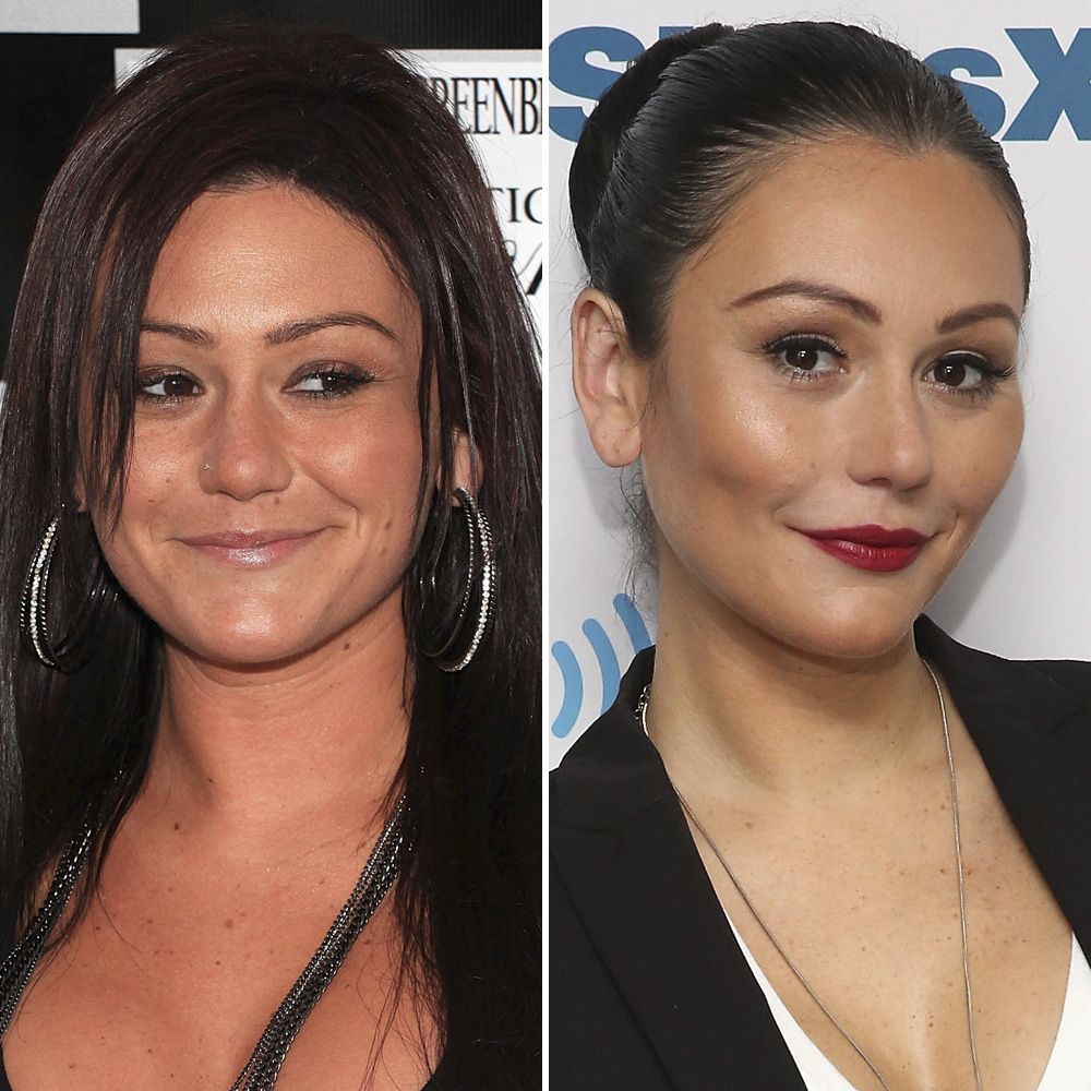 Plastic surgery jwoww