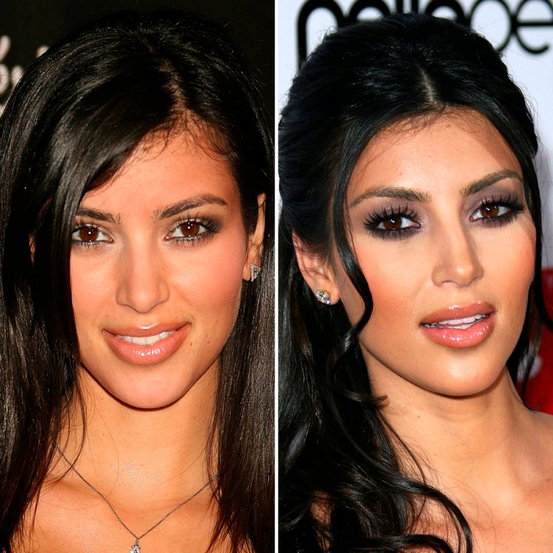 Plastic surgery kim kardashian