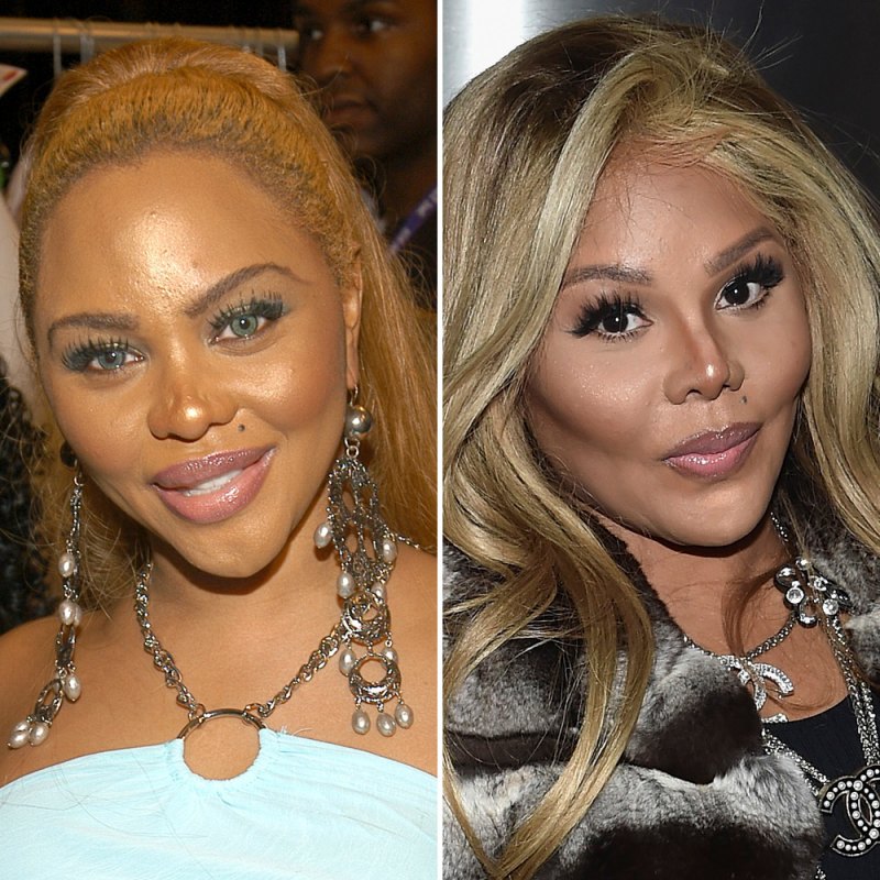Plastic surgery lil kim copy