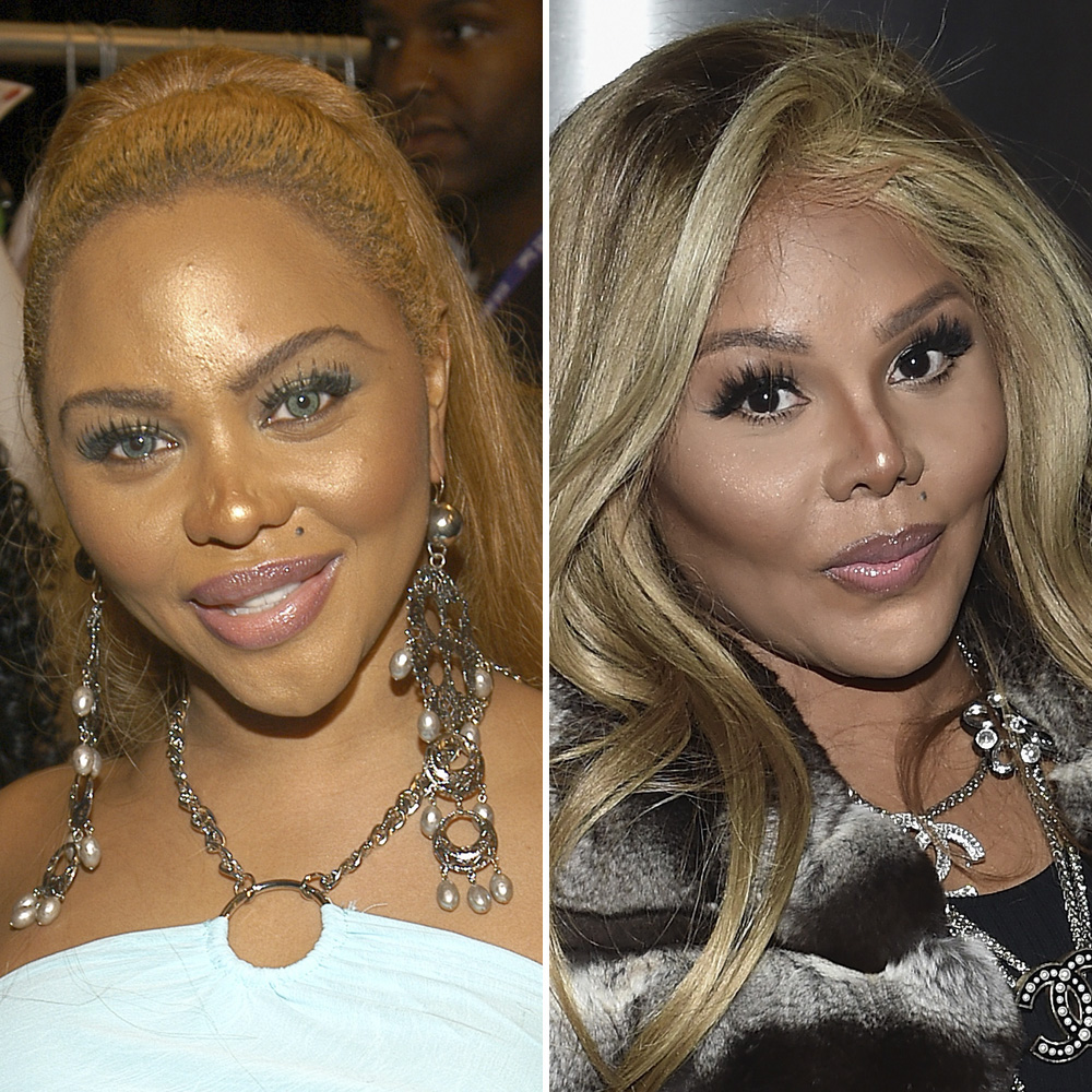 Plastic surgery lil kim copy